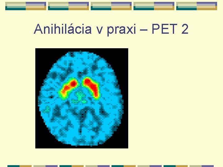 Anihilácia v praxi – PET 2 