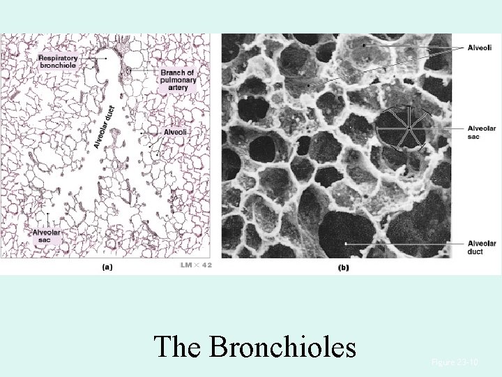 The Bronchioles Figure 23– 10 The Bronchioles Figure 23– 10