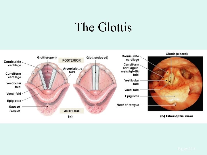 The Glottis Figure 23– 5 The Glottis Figure 23– 5