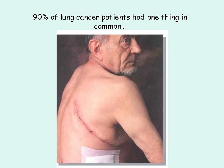 90% of lung cancer patients had one thing in common… 90% of lung cancer patients had one thing in common…