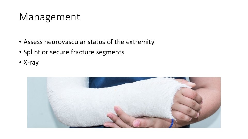 Management • Assess neurovascular status of the extremity • Splint or secure fracture segments