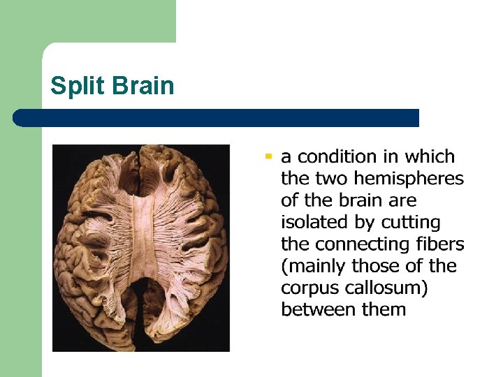 Split Brain 