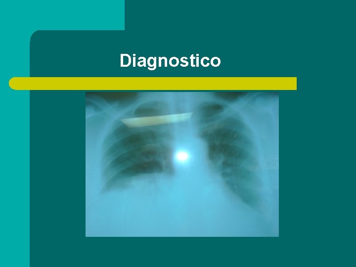 Diagnostico 