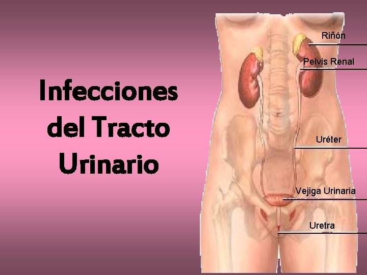 Riñón Pelvis Renal Infecciones del Tracto Urinario Uréter Vejiga Urinaria Uretra 