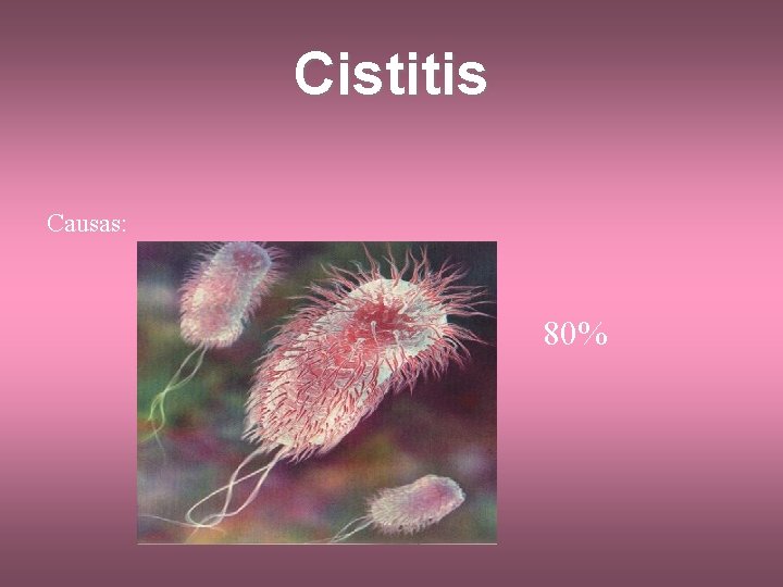 Cistitis Causas: 80% 