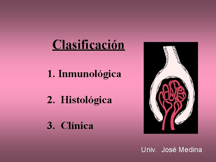 Clasificación 1. Inmunológica 2. Histológica 3. Clínica Univ. José Medina 