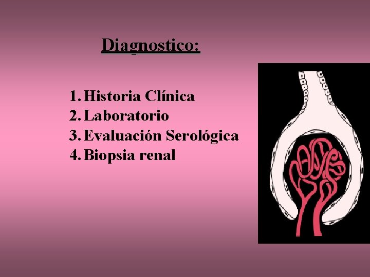 Diagnostico: 1. Historia Clínica 2. Laboratorio 3. Evaluación Serológica 4. Biopsia renal 