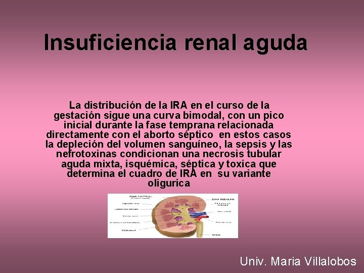 Insuficiencia renal aguda La distribución de la IRA en el curso de la gestación
