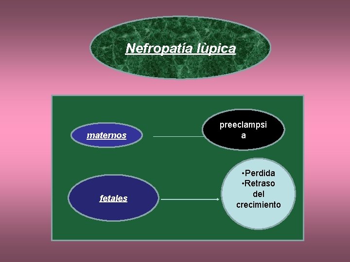 Nefropatía lùpica maternos fetales preeclampsi a • Perdida • Retraso del crecimiento 