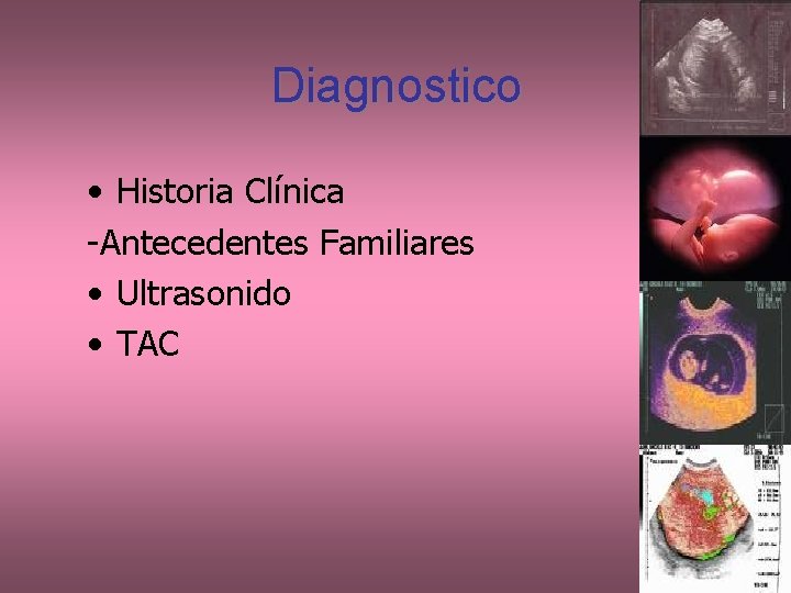 Diagnostico • Historia Clínica -Antecedentes Familiares • Ultrasonido • TAC 