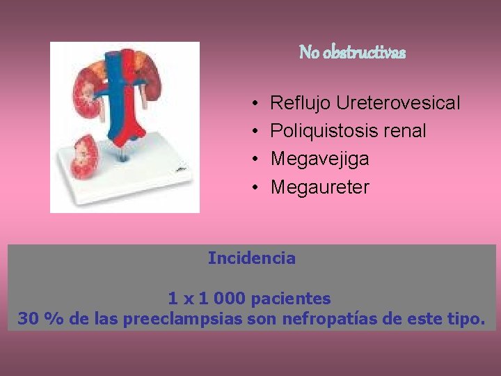No obstructivas • • Reflujo Ureterovesical Poliquistosis renal Megavejiga Megaureter Incidencia 1 x 1