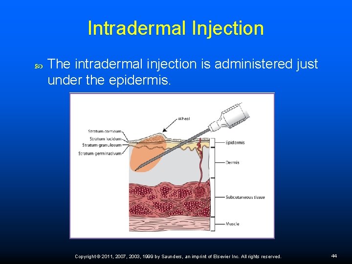Intradermal Injection The intradermal injection is administered just under the epidermis. Copyright © 2011,