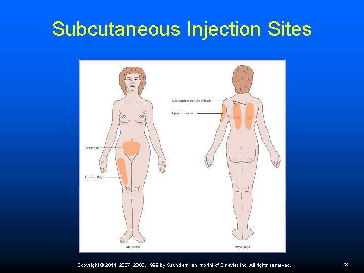 Subcutaneous Injection Sites Copyright © 2011, 2007, 2003, 1999 by Saunders, an imprint of