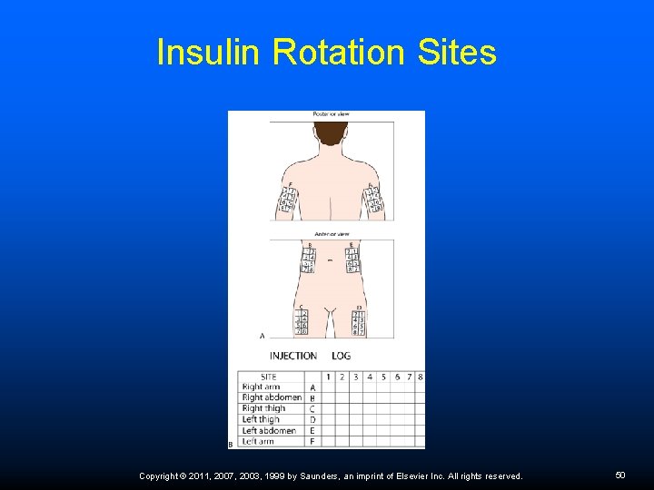 Insulin Rotation Sites Copyright © 2011, 2007, 2003, 1999 by Saunders, an imprint of