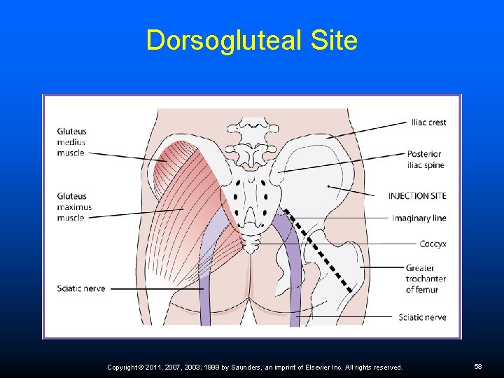 Dorsogluteal Site Copyright © 2011, 2007, 2003, 1999 by Saunders, an imprint of Elsevier