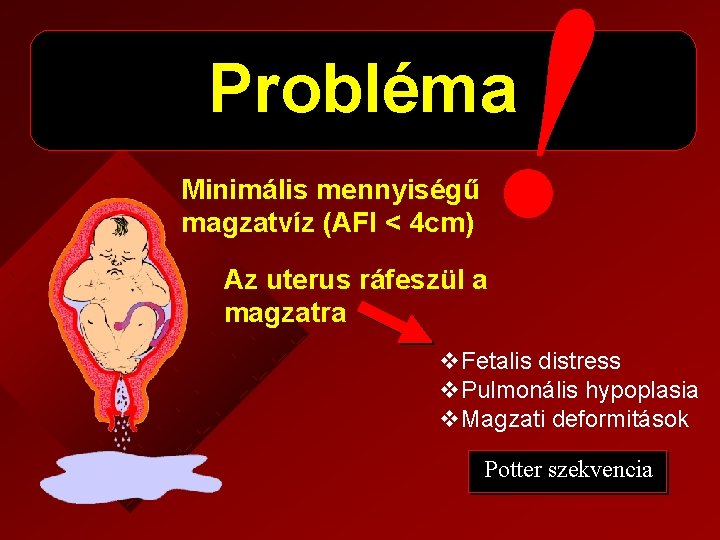 ! Probléma Minimális mennyiségű magzatvíz (AFI < 4 cm) Az uterus ráfeszül a magzatra