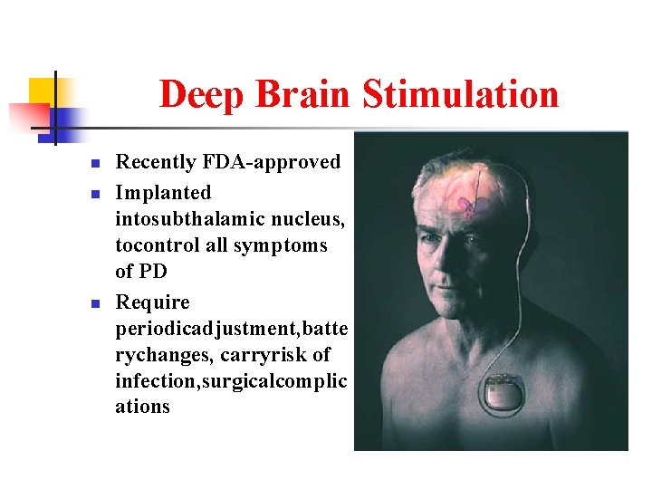 Deep Brain Stimulation n Recently FDA-approved Implanted intosubthalamic nucleus, tocontrol all symptoms of PD