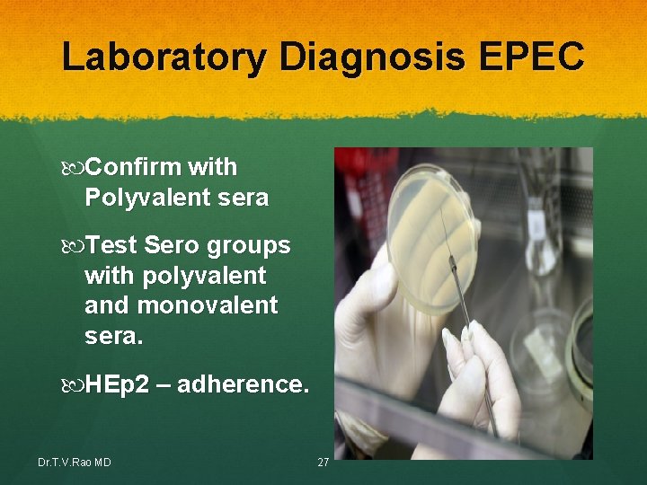 Laboratory Diagnosis EPEC Confirm with Polyvalent sera Test Sero groups with polyvalent and monovalent Laboratory Diagnosis EPEC Confirm with Polyvalent sera Test Sero groups with polyvalent and monovalent