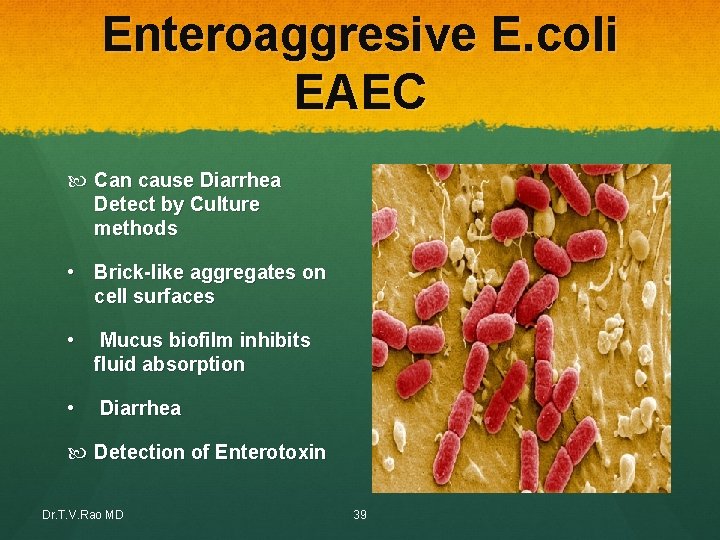 Enteroaggresive E. coli EAEC Can cause Diarrhea Detect by Culture methods • Brick-like aggregates Enteroaggresive E. coli EAEC Can cause Diarrhea Detect by Culture methods • Brick-like aggregates