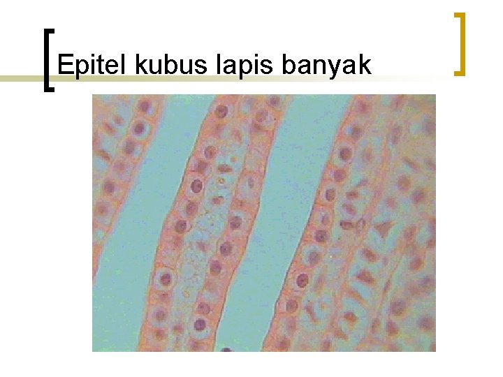 Epitel kubus lapis banyak 