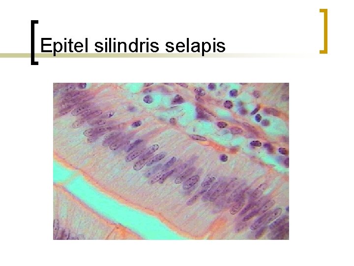 Epitel silindris selapis 