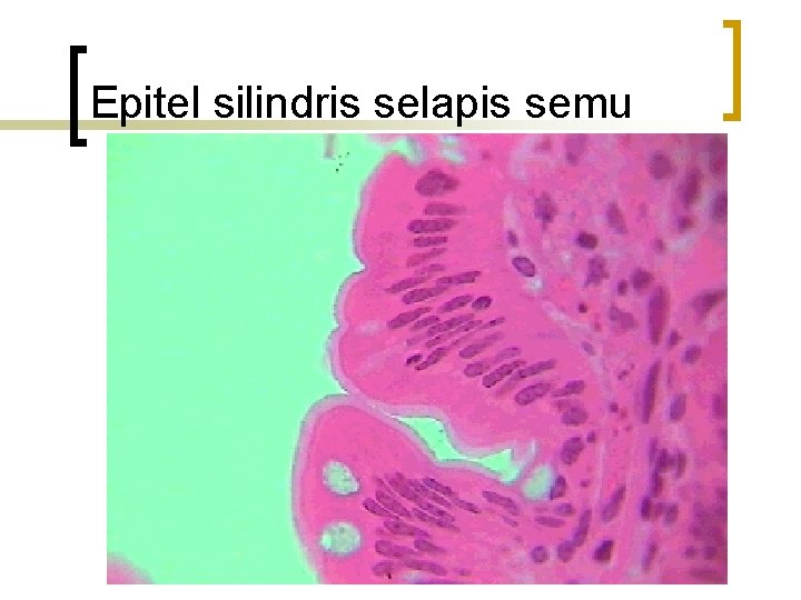 Epitel silindris selapis semu 