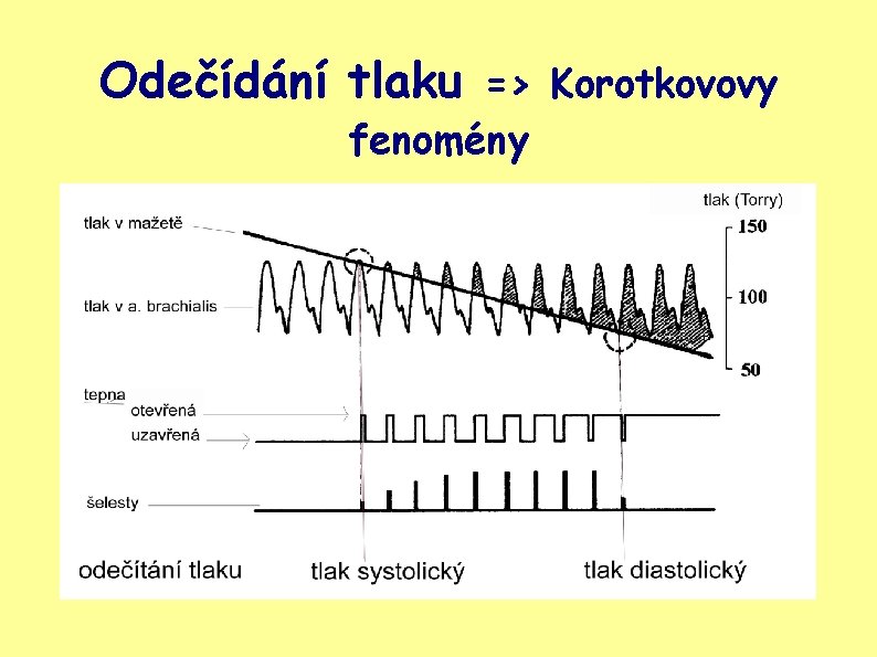 Odečídání tlaku => Korotkovovy fenomény 