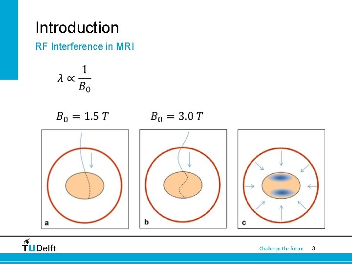 Introduction RF Interference in MRI Challenge the future 3 