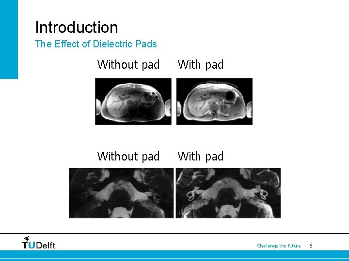 Introduction The Effect of Dielectric Pads Without pad With pad Challenge the future 6