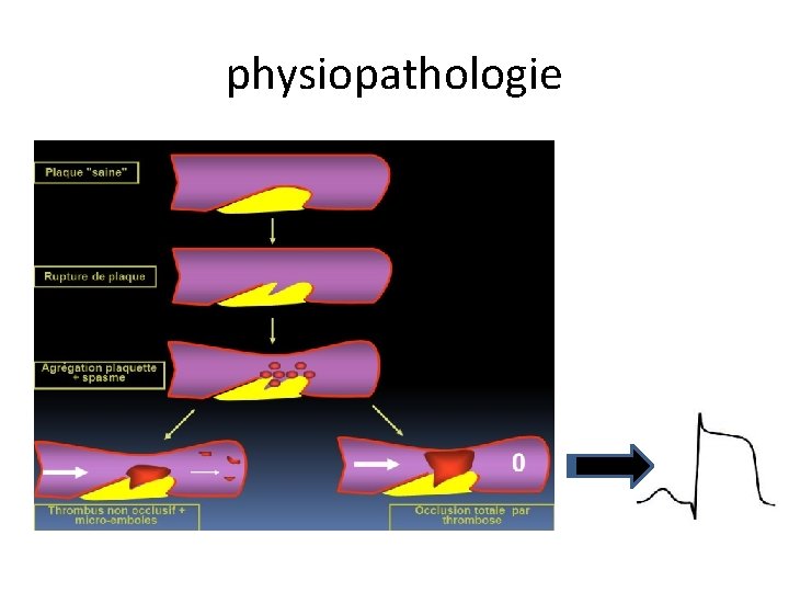 physiopathologie 