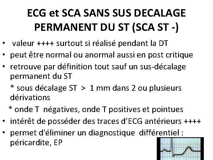 ECG et SCA SANS SUS DECALAGE PERMANENT DU ST (SCA ST -) • valeur