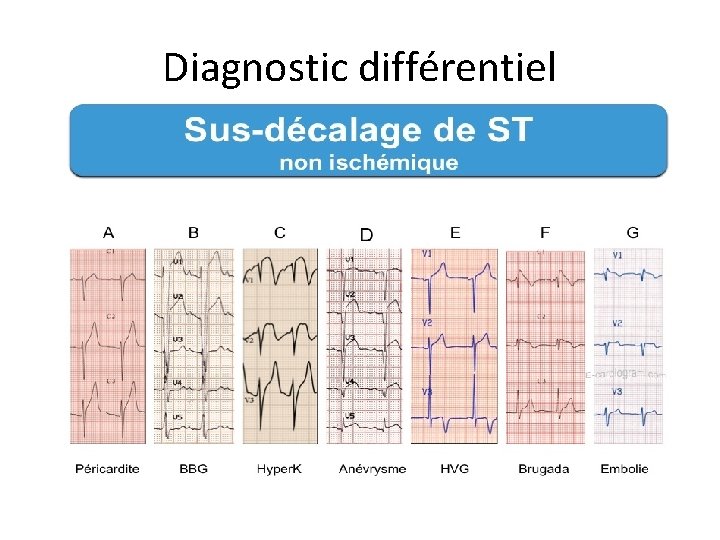 Diagnostic différentiel 