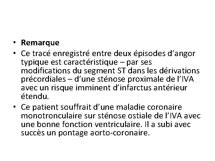  • Remarque • Ce tracé enregistré entre deux épisodes d’angor typique est caractéristique