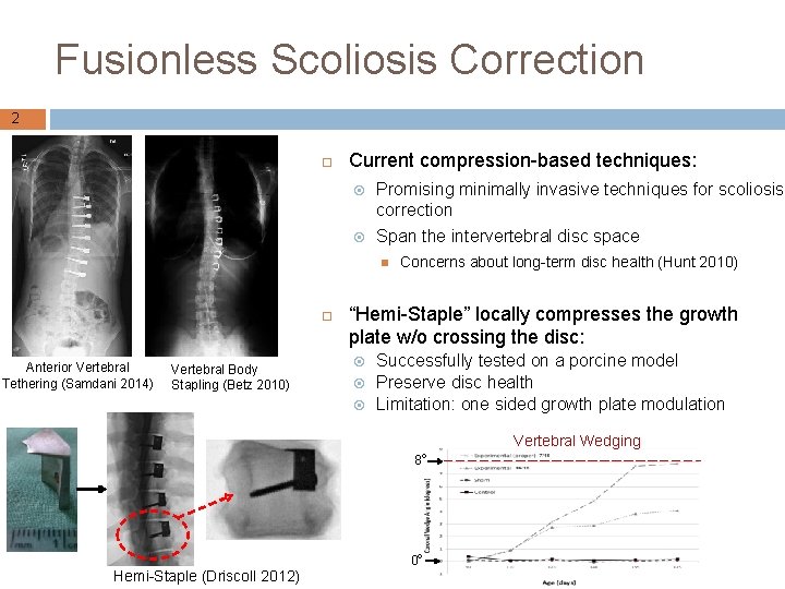 Fusionless Scoliosis Correction 2 Current compression-based techniques: Promising minimally invasive techniques for scoliosis correction