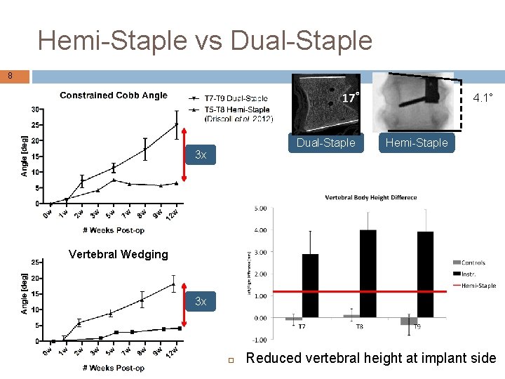 Hemi-Staple vs Dual-Staple 8 4. 1° Dual-Staple 3 x Hemi-Staple Vertebral Wedging 3 x
