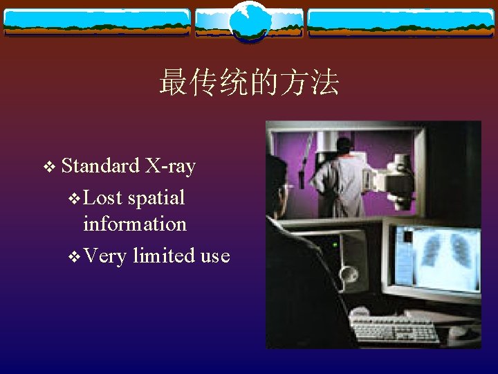 最传统的方法 v Standard X-ray v. Lost spatial information v. Very limited use 