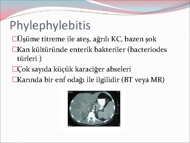 Phylephylebitis �Üşüme titreme ile ateş, ağrılı KC, bazen şok �Kan kültüründe enterik bakteriler (bacteriodes