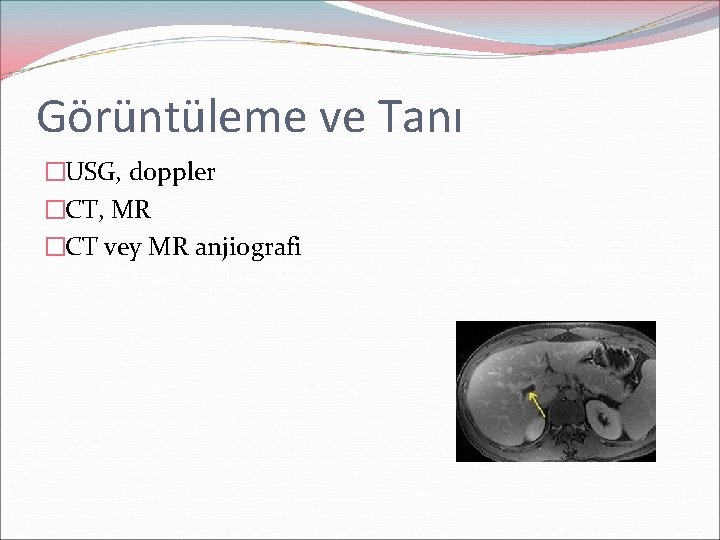 Görüntüleme ve Tanı �USG, doppler �CT, MR �CT vey MR anjiografi 