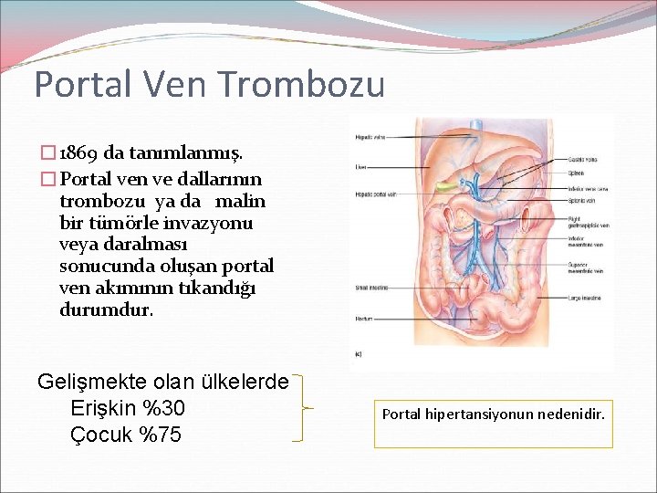 Portal Ven Trombozu � 1869 da tanımlanmış. �Portal ven ve dallarının trombozu ya da