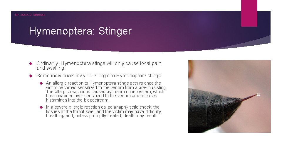 Mr. Jason S. Martinez Hymenoptera: Stinger Ordinarily, Hymenoptera stings will only cause local pain Mr. Jason S. Martinez Hymenoptera: Stinger Ordinarily, Hymenoptera stings will only cause local pain