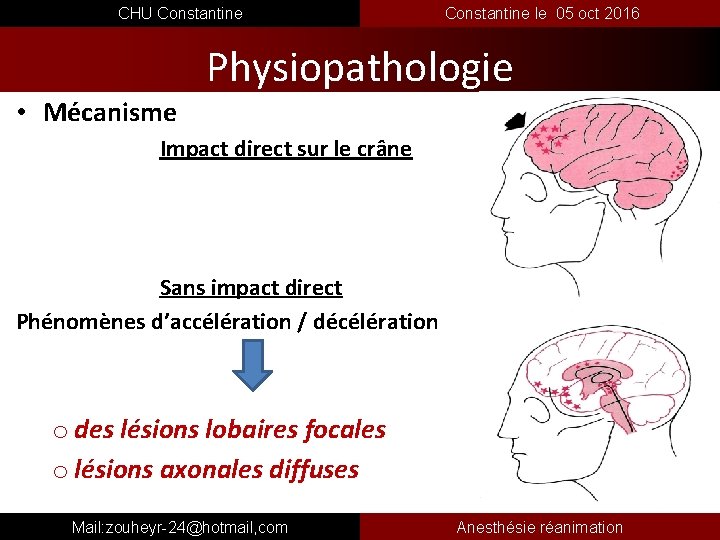  CHU Constantine le 05 oct 2016 Physiopathologie • Mécanisme Impact direct sur le