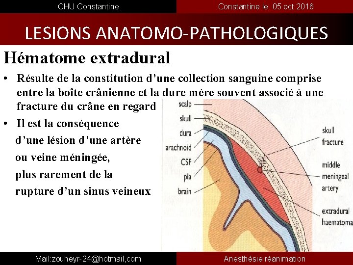  CHU Constantine le 05 oct 2016 LESIONS ANATOMO-PATHOLOGIQUES Hématome extradural • Résulte de