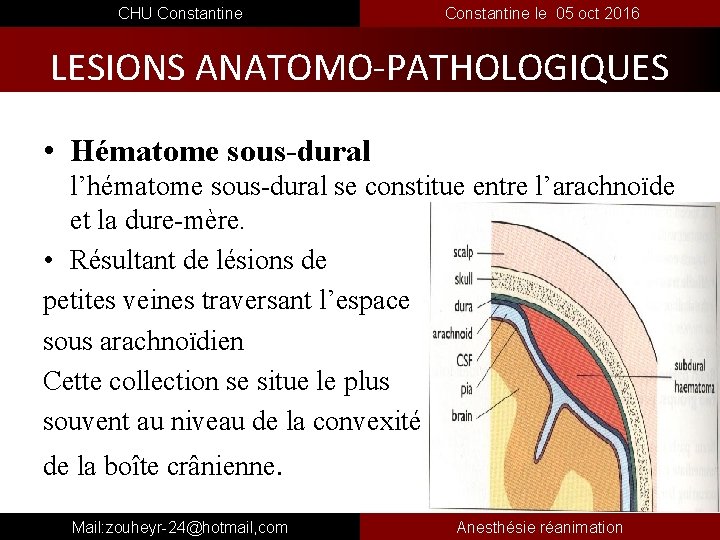  CHU Constantine le 05 oct 2016 LESIONS ANATOMO-PATHOLOGIQUES • Hématome sous-dural l’hématome sous-dural