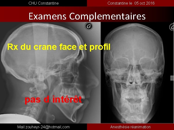  CHU Constantine le 05 oct 2016 Examens Complementaires Rx du crane face et