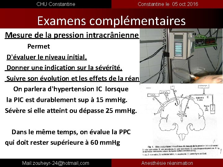  CHU Constantine le 05 oct 2016 Examens complémentaires Mesure de la pression intracrânienne