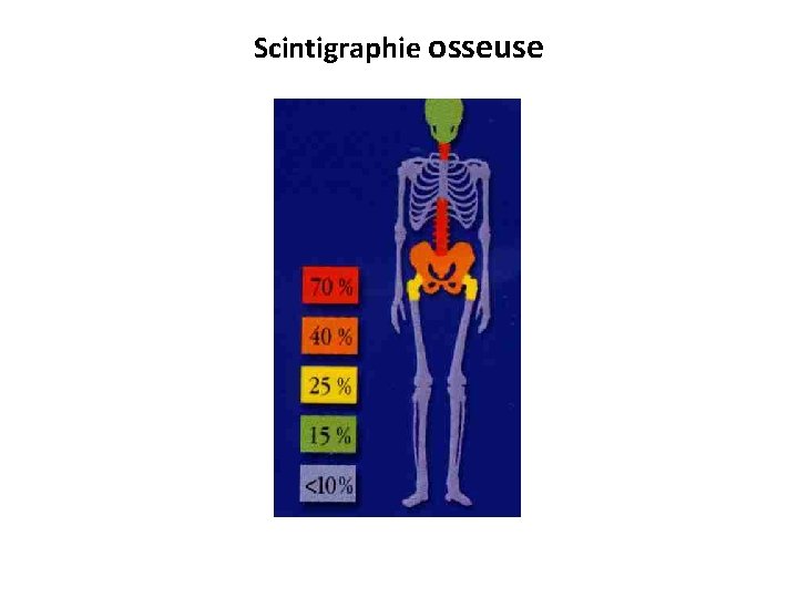 Scintigraphie osseuse 
