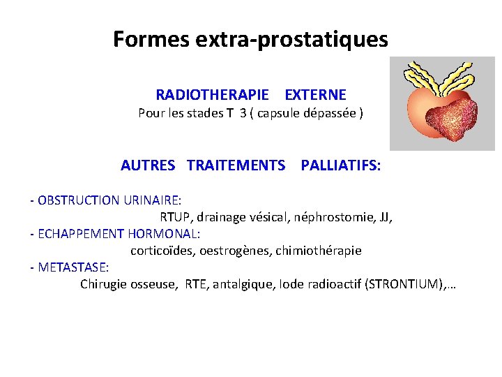 Formes extra-prostatiques RADIOTHERAPIE EXTERNE Pour les stades T 3 ( capsule dépassée ) AUTRES