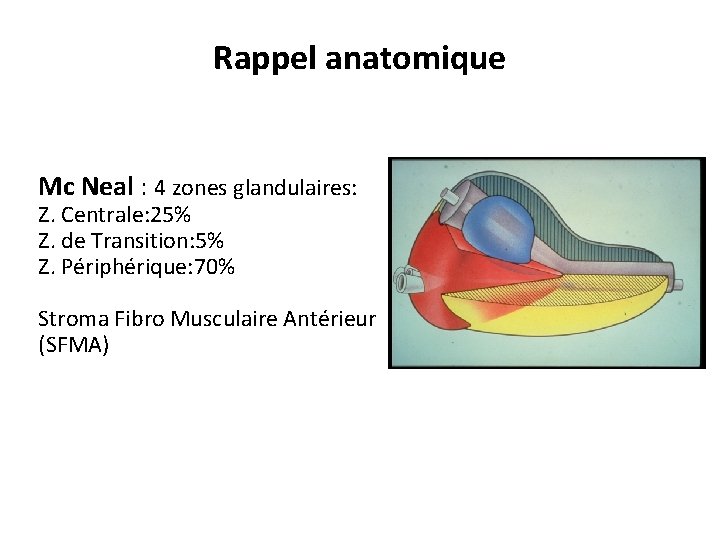 Rappel anatomique Mc Neal : 4 zones glandulaires: Z. Centrale: 25% Z. de Transition: