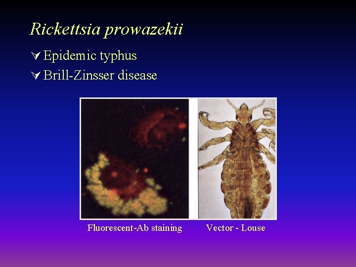 Rickettsia prowazekii Ú Epidemic typhus Ú Brill-Zinsser disease Fluorescent-Ab staining Vector - Louse 