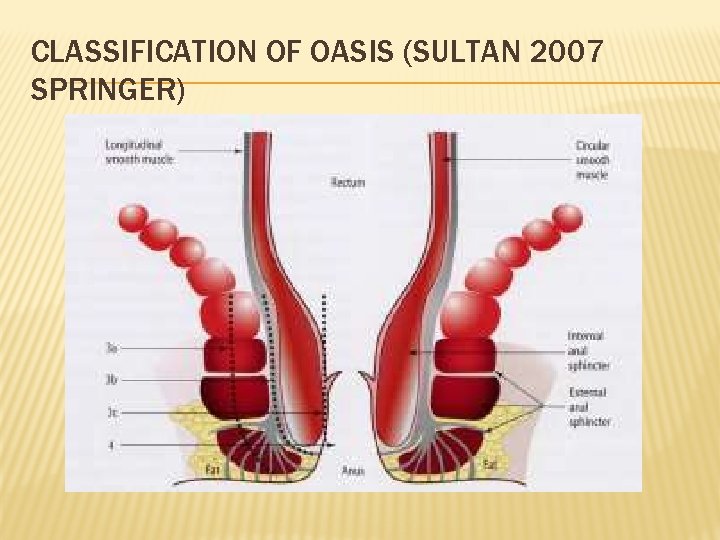 CLASSIFICATION OF OASIS (SULTAN 2007 SPRINGER) CLASSIFICATION OF OASIS (SULTAN 2007 SPRINGER)